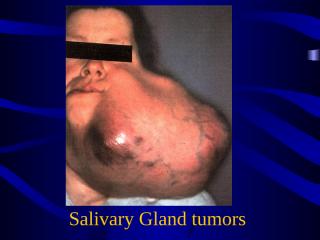 pathology_final_practical_salivary gland tumors.ppt